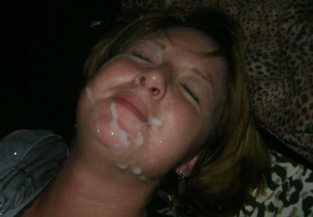20P Hot facials