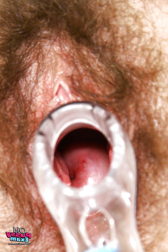16P Mature brunette in jeans gets her bushy cunt examed by gyno