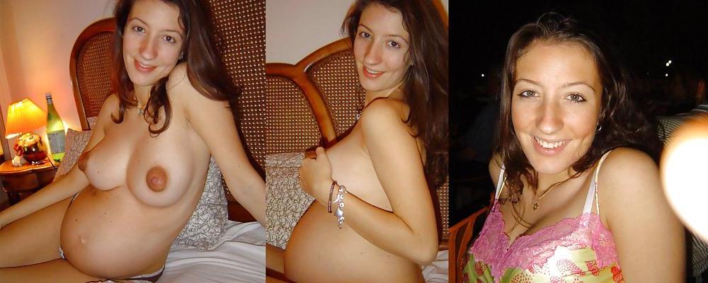 21P Pregnant Amateurs - Dressed & Undressed 3