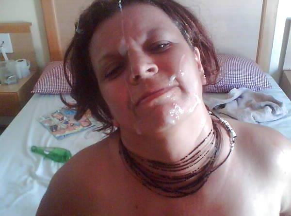 15P More facials