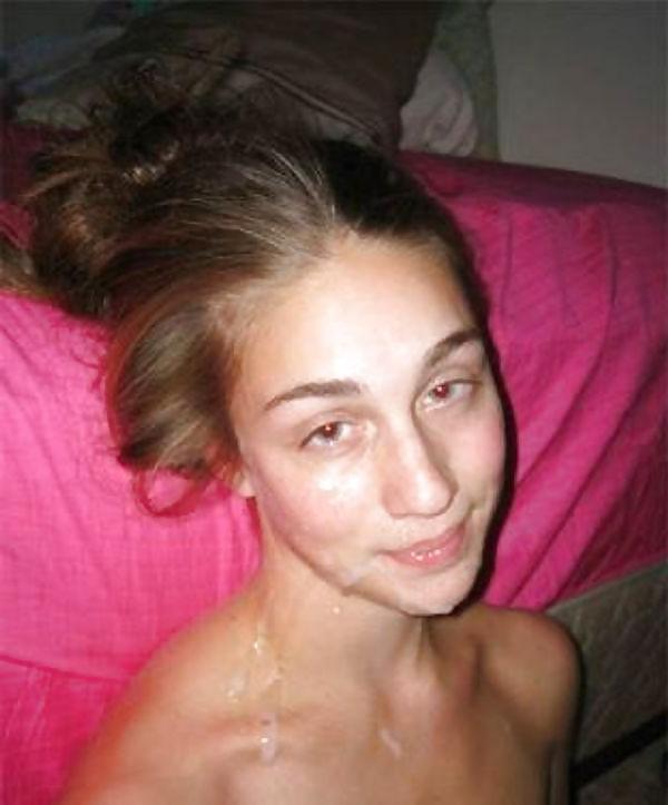 15P More facials