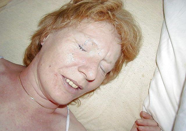 15P Facials