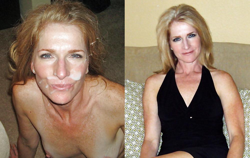 25P Before and after