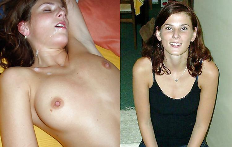 25P Before and after