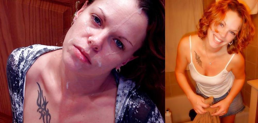 25P Before and after