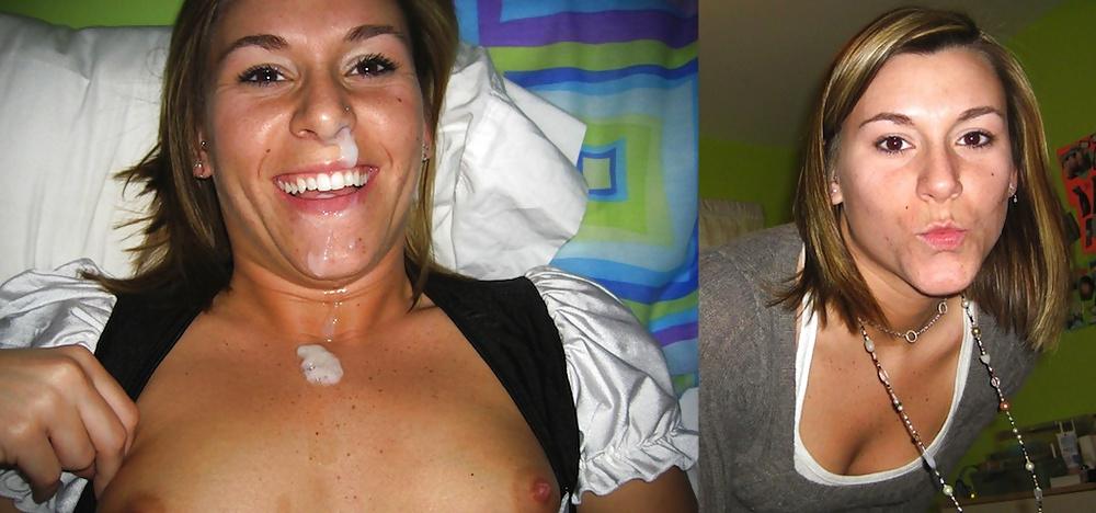 25P Before and after