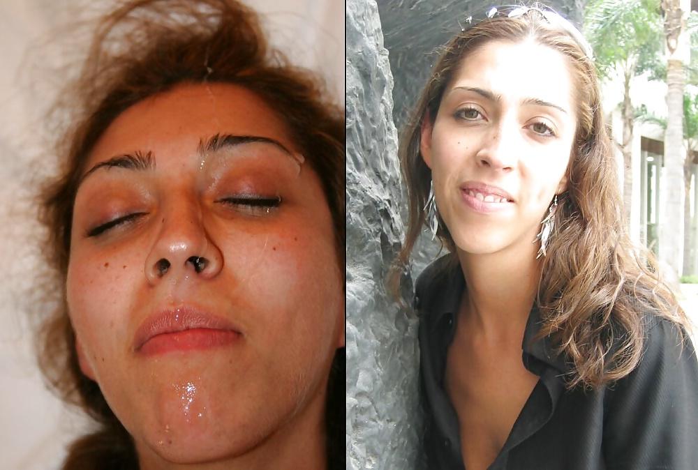 25P Before and after