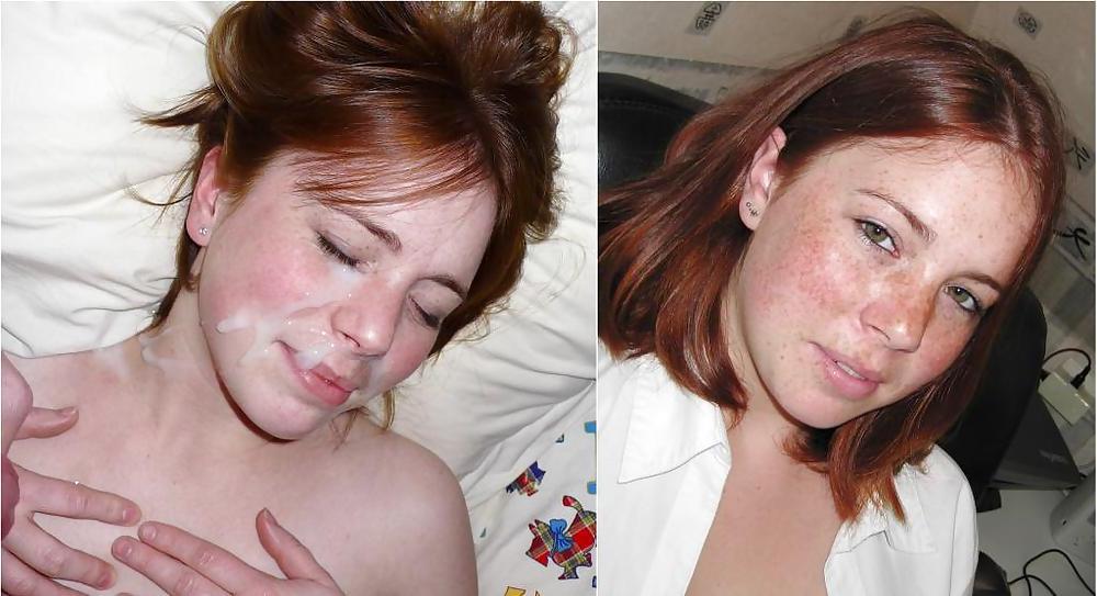 25P Before and after