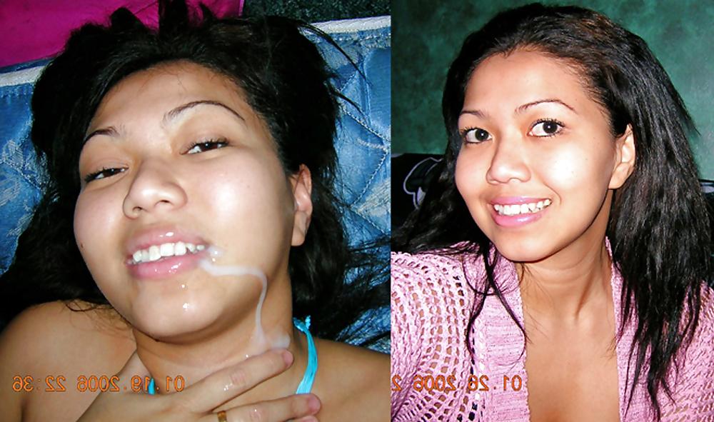 25P Before and after