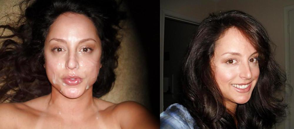 25P Before and after