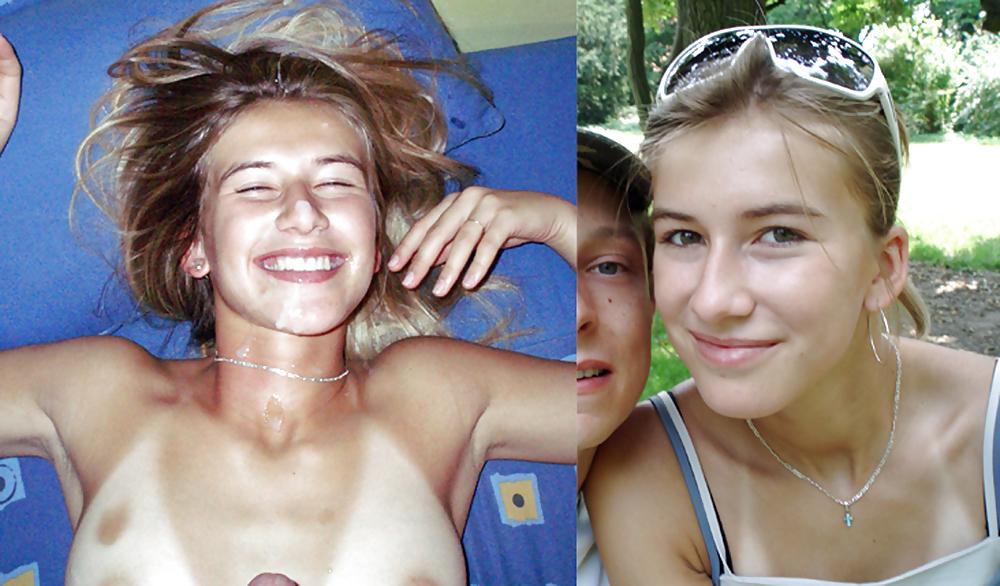 25P Before and after