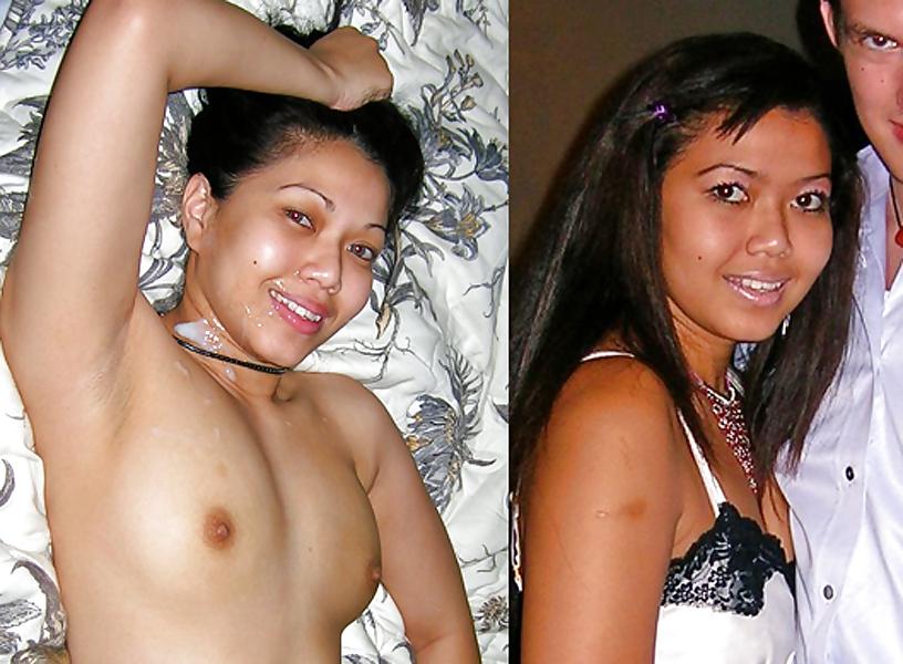25P Before and after
