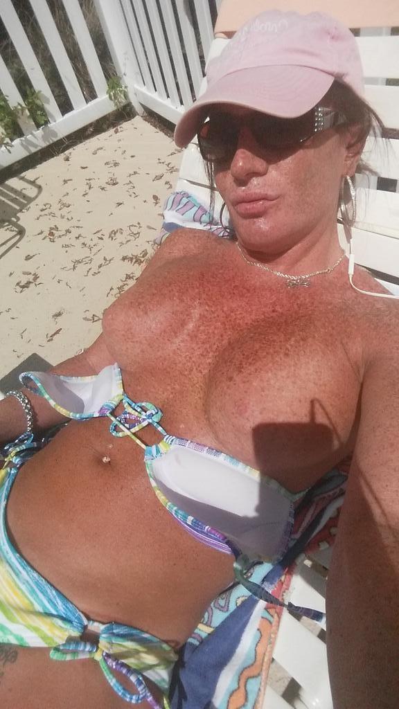 10P Freckled bikini shemale