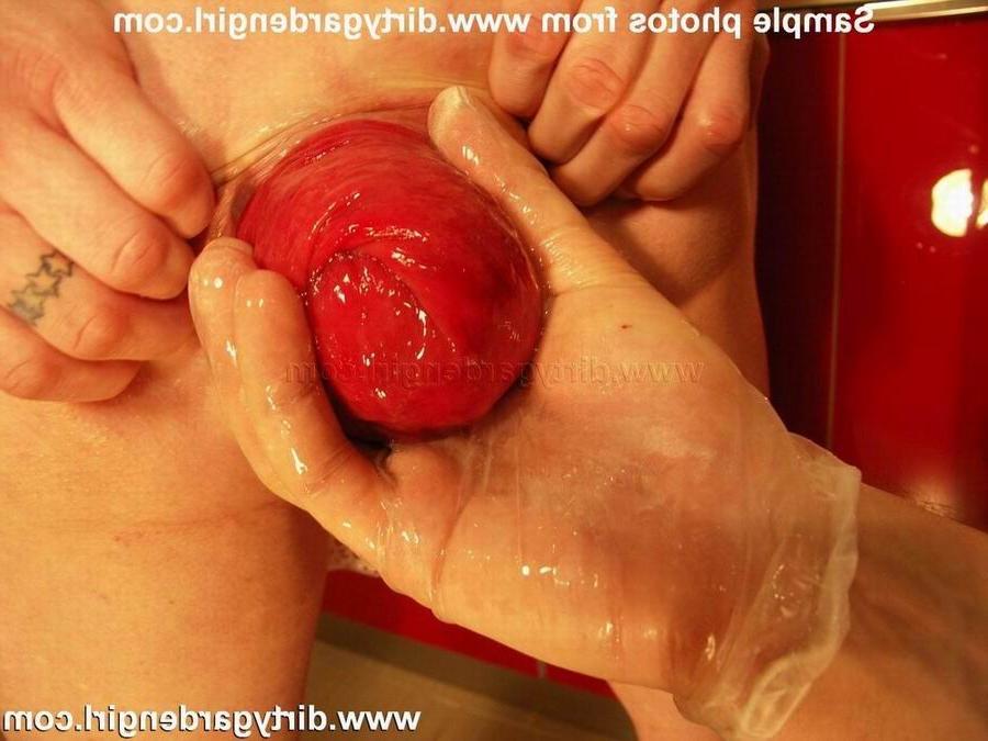 18P extreme milf toying her prolapsed ass