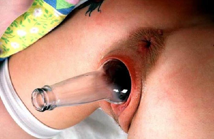 14P Extreme bottle insertions