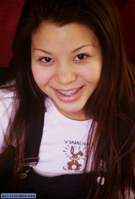 15P Hairy asian teen in braces