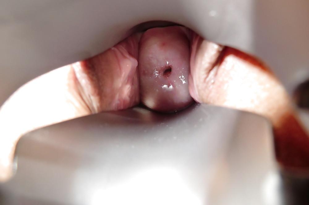 9P KInky speculum fun