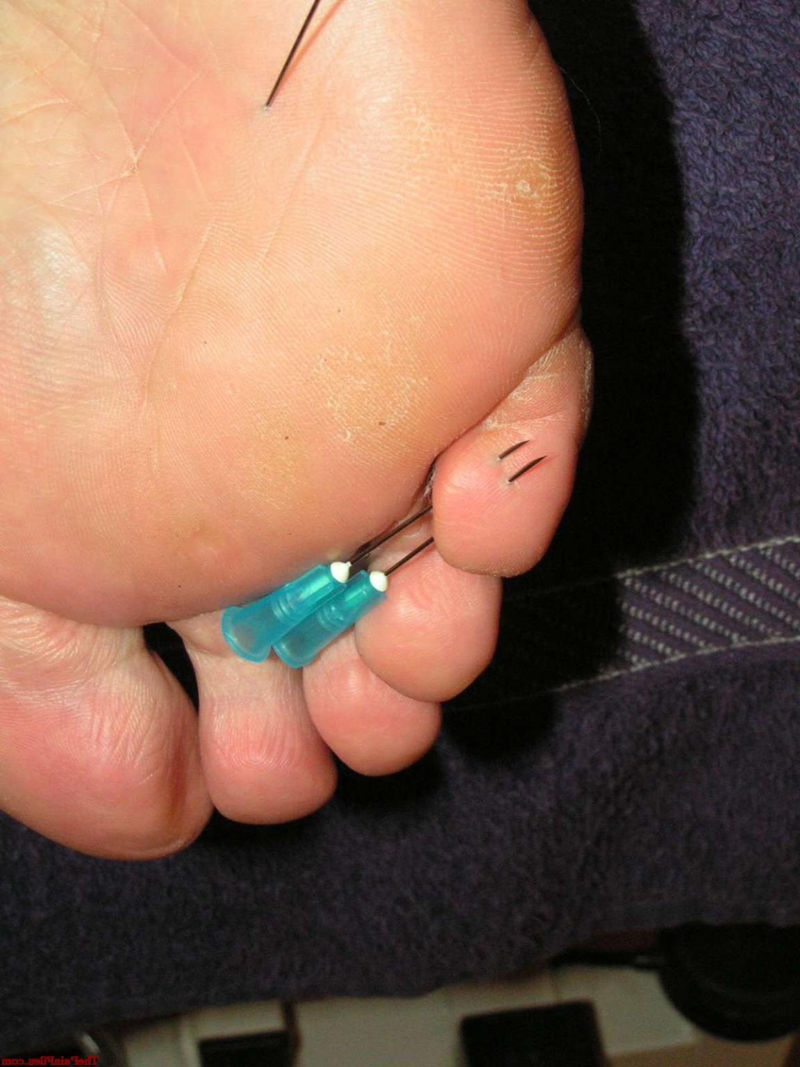 16P Mature painsluts electro torture and needle pain on nipples and feet for Sophia
