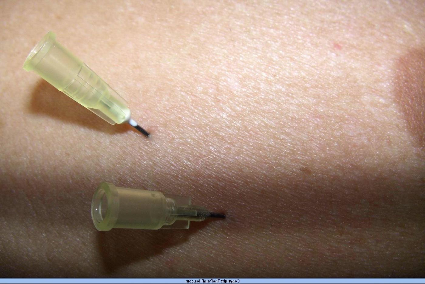 16P Mature german bdsm lifestyle slavegirl in bizarre needle pain torments