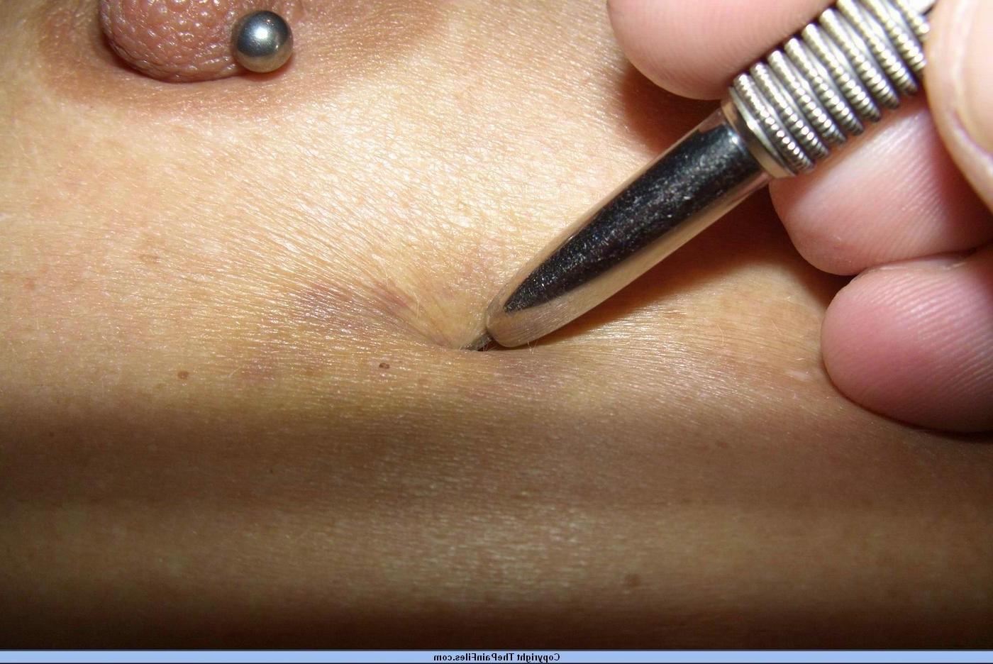 16P Mature german bdsm lifestyle slavegirl in bizarre needle pain torments