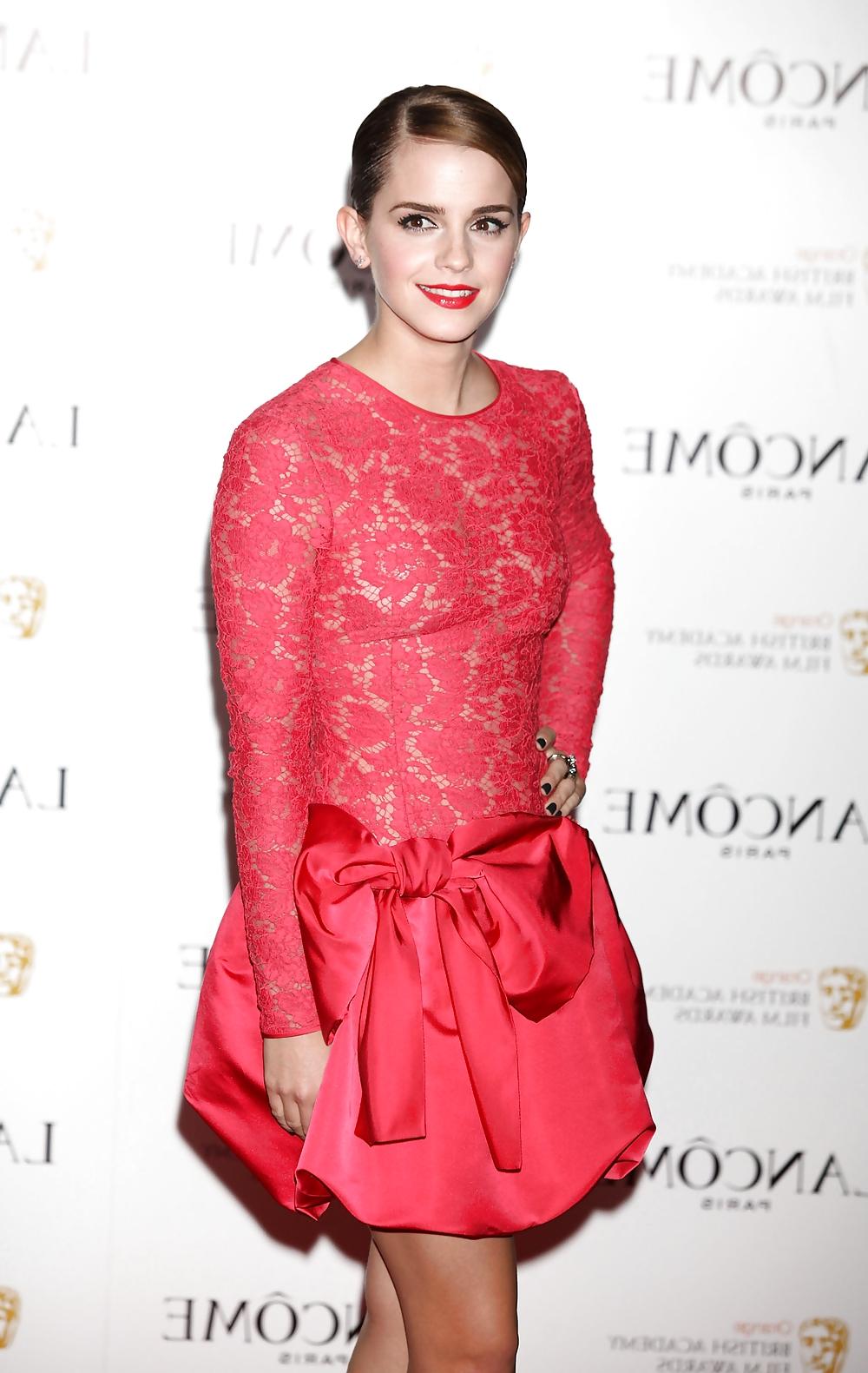 25P Emma Watson, No Bra, Lace Dress = Nipples