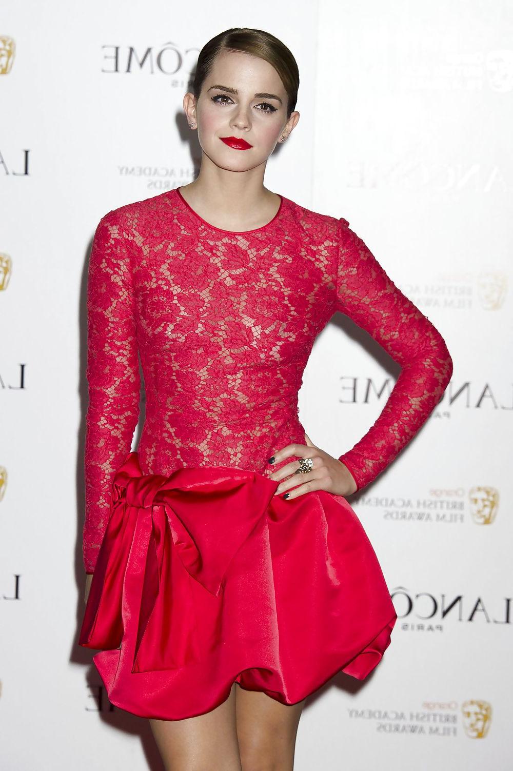 25P Emma Watson, No Bra, Lace Dress = Nipples