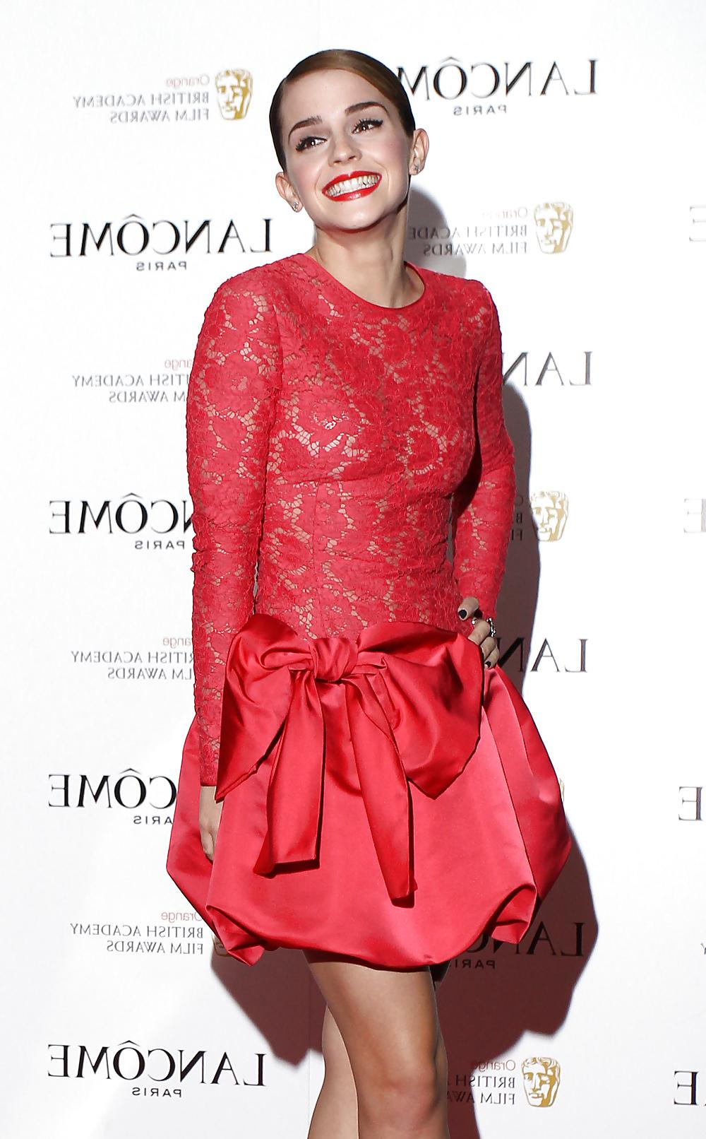 25P Emma Watson, No Bra, Lace Dress = Nipples