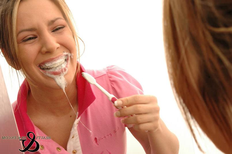 16P Babe in shiny wet metal mouth braces sloppily brushing her teeth