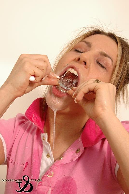 16P Babe in shiny wet metal mouth braces sloppily brushing her teeth