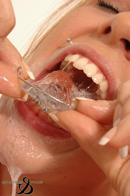 16P Babe in shiny wet metal mouth braces sloppily brushing her teeth