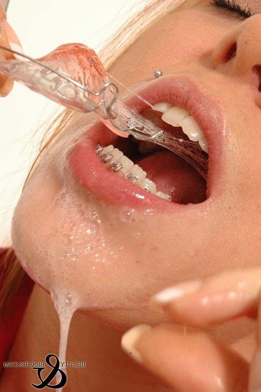 16P Babe in shiny wet metal mouth braces sloppily brushing her teeth