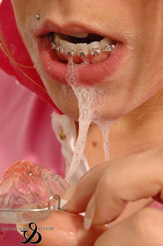 16P Babe in shiny wet metal mouth braces sloppily brushing her teeth