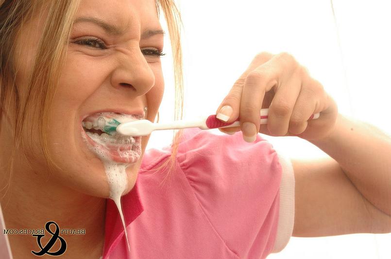 16P Babe in shiny wet metal mouth braces sloppily brushing her teeth