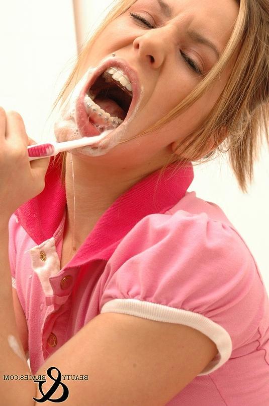 16P Babe in shiny wet metal mouth braces sloppily brushing her teeth