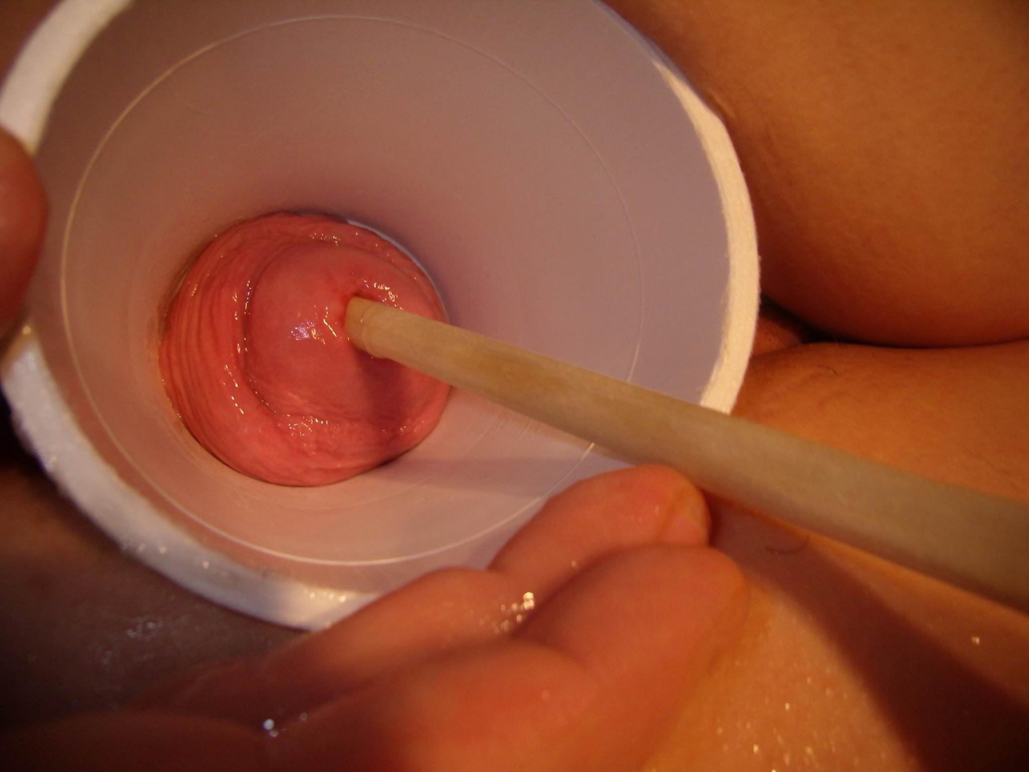 16P extreme pussy and anal speculum insertions