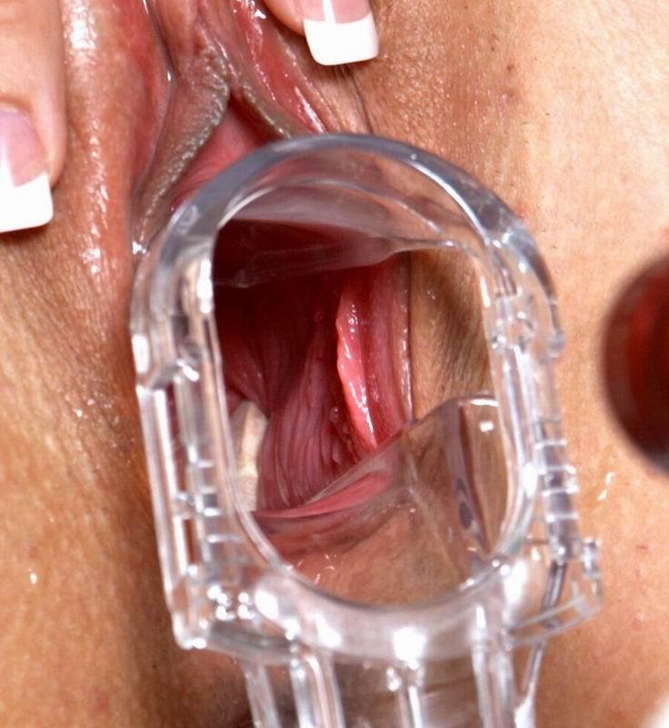 16P extreme pussy and anal speculum insertions