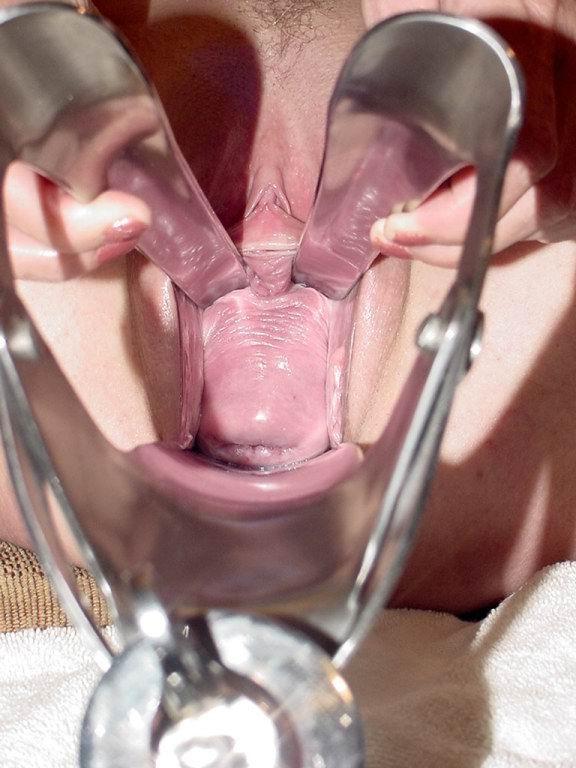 16P extreme pussy and anal speculum insertions