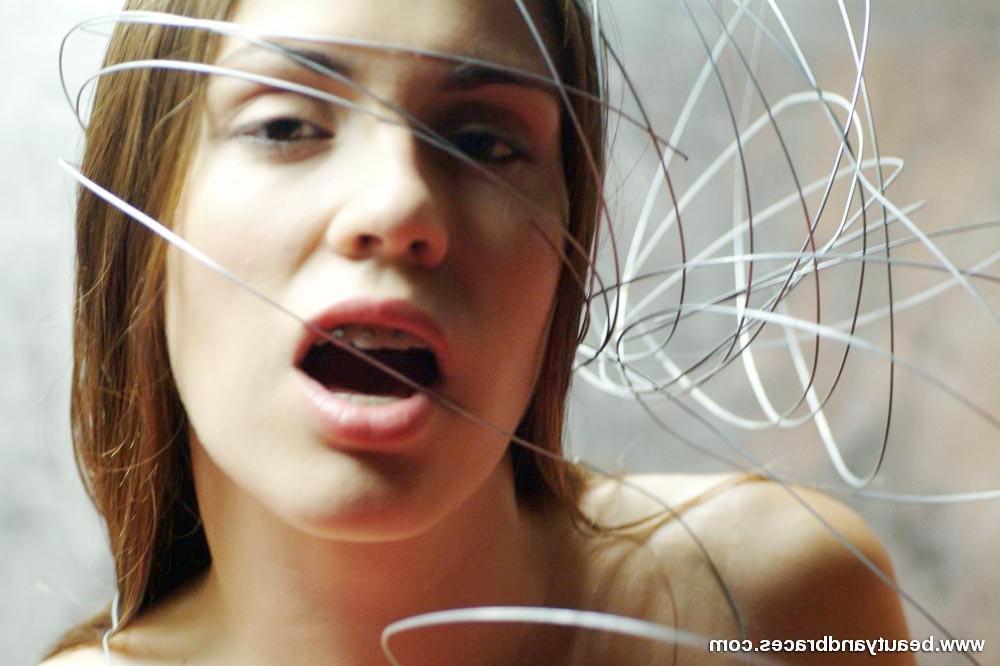 16P Nude blonde teen with braces has her head wrapped in wire