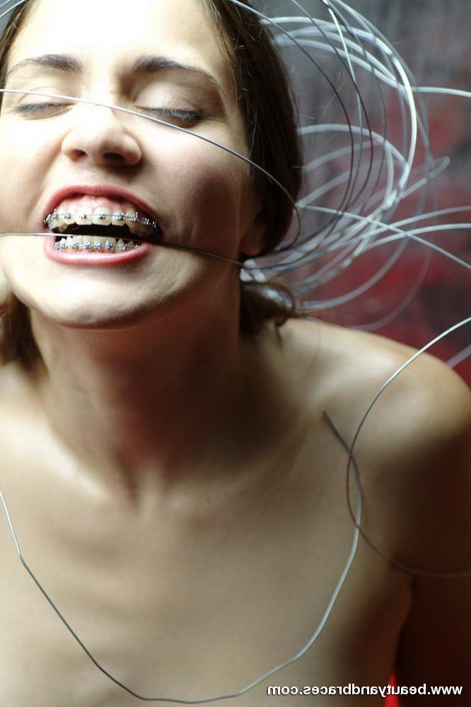 16P Nude blonde teen with braces has her head wrapped in wire