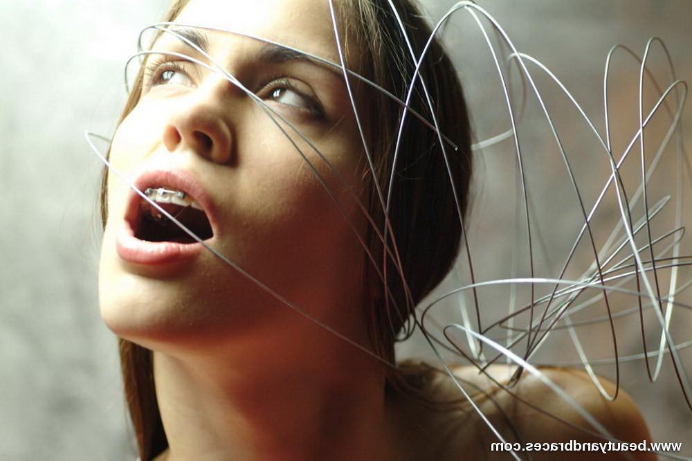 16P Nude blonde teen with braces has her head wrapped in wire