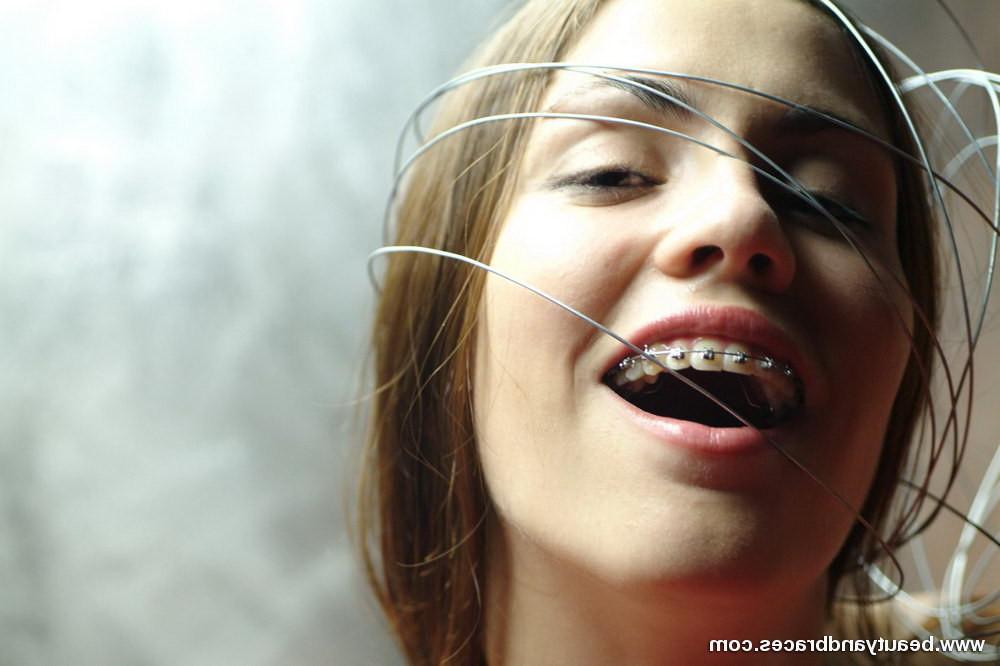 16P Nude blonde teen with braces has her head wrapped in wire