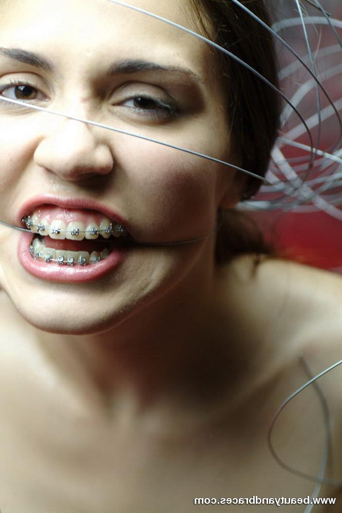 16P Nude blonde teen with braces has her head wrapped in wire