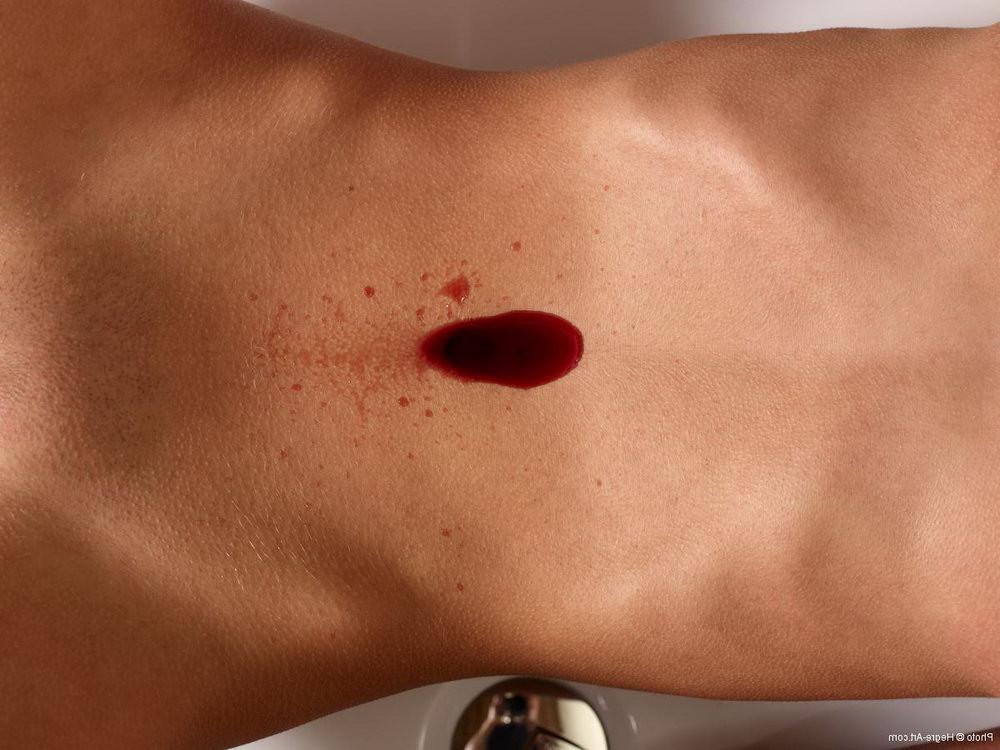 16P nude girl in bath. It's excessive menstruation? Or red wine?