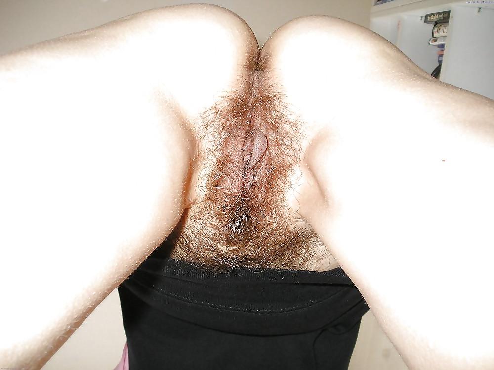 25P Hairy.  Cunt.  Legs.  Pits.
