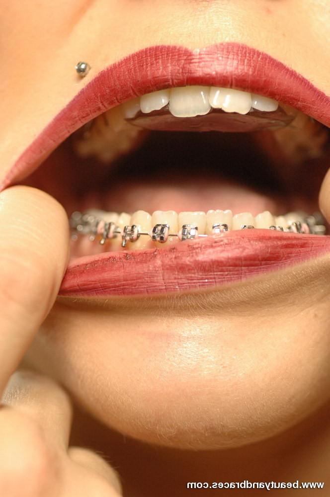 16P Hot blonde with braces takes of her vinyl bikini and spreads