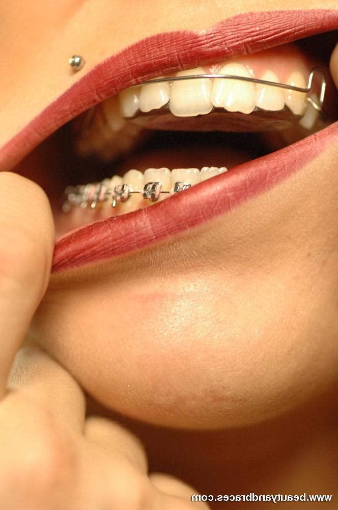 16P Hot blonde with braces takes of her vinyl bikini and spreads