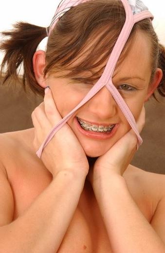 16P Teen girl with braces pulling her lips
