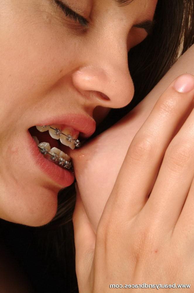 16P Two cuties with braces nibbling and sucking at each other