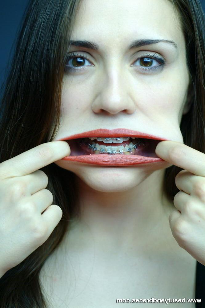 16P Cute brunette teen with braces stretches her mouth wide open