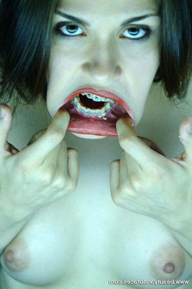16P Cute brunette teen with braces stretches her mouth wide open